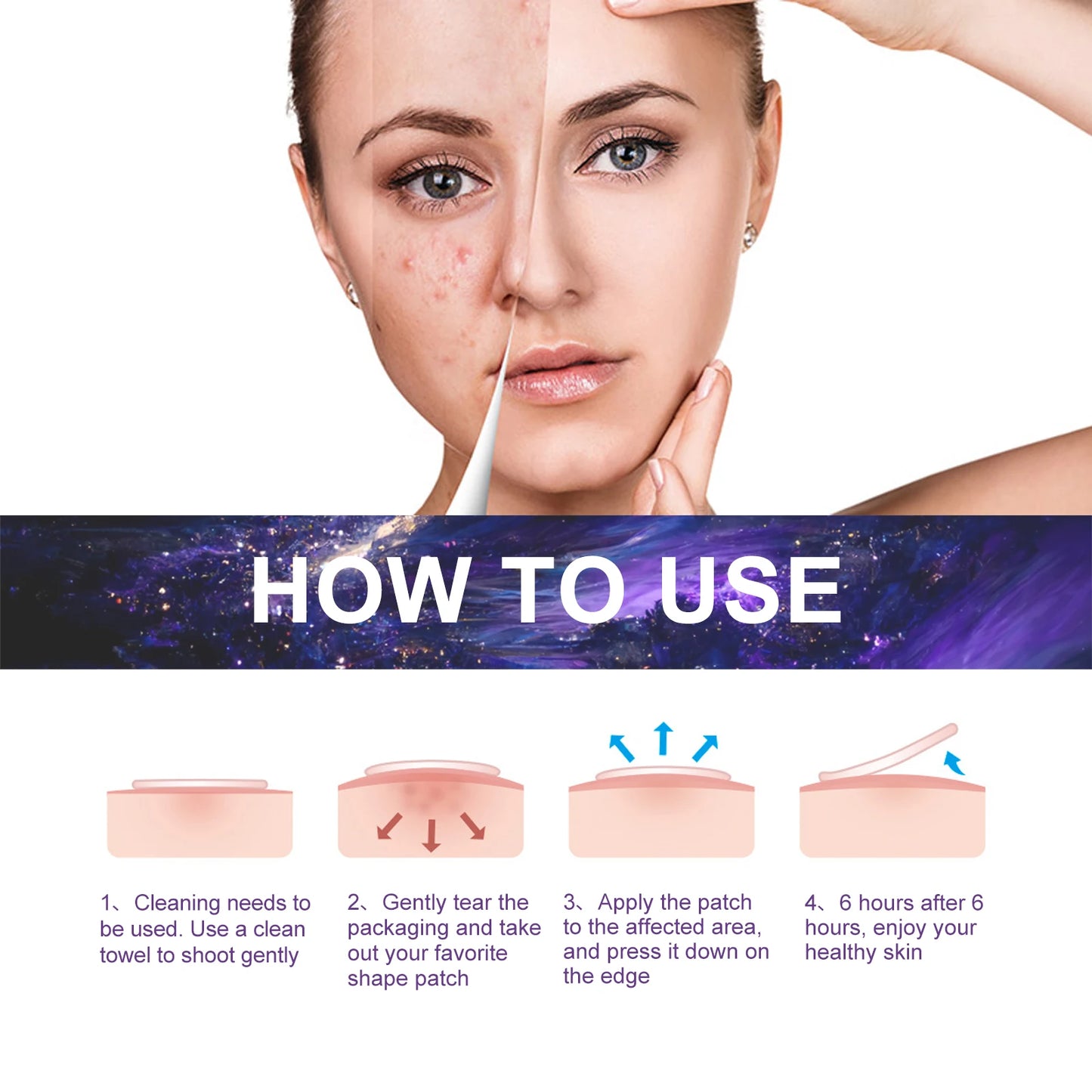 Facial Acne Patch Water Gel Acne Stickers Fade Acne suitable for Women