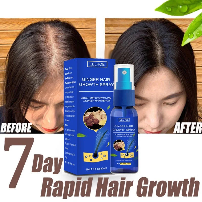 Ginger Hair Growth spray Anti Hair Fall Hair Loss Treatment