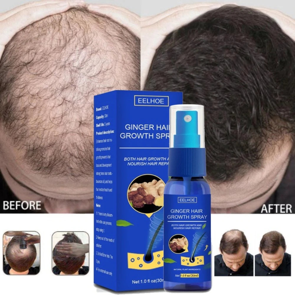 Ginger Hair Growth spray Anti Hair Fall Hair Loss Treatment