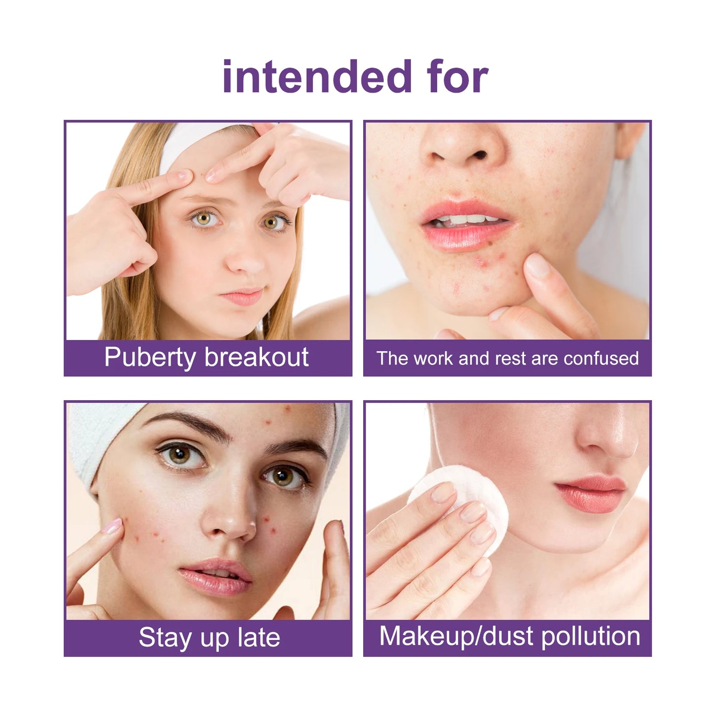 Facial Acne Patch Water Gel Acne Stickers Fade Acne suitable for Women