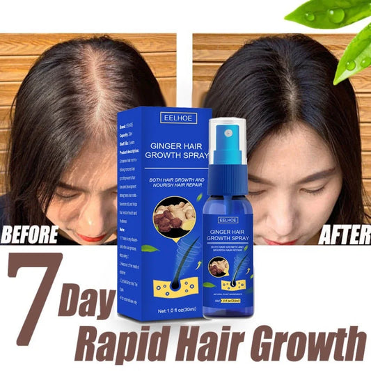 Ginger Hair Growth spray Anti Hair Fall Hair Loss Treatment