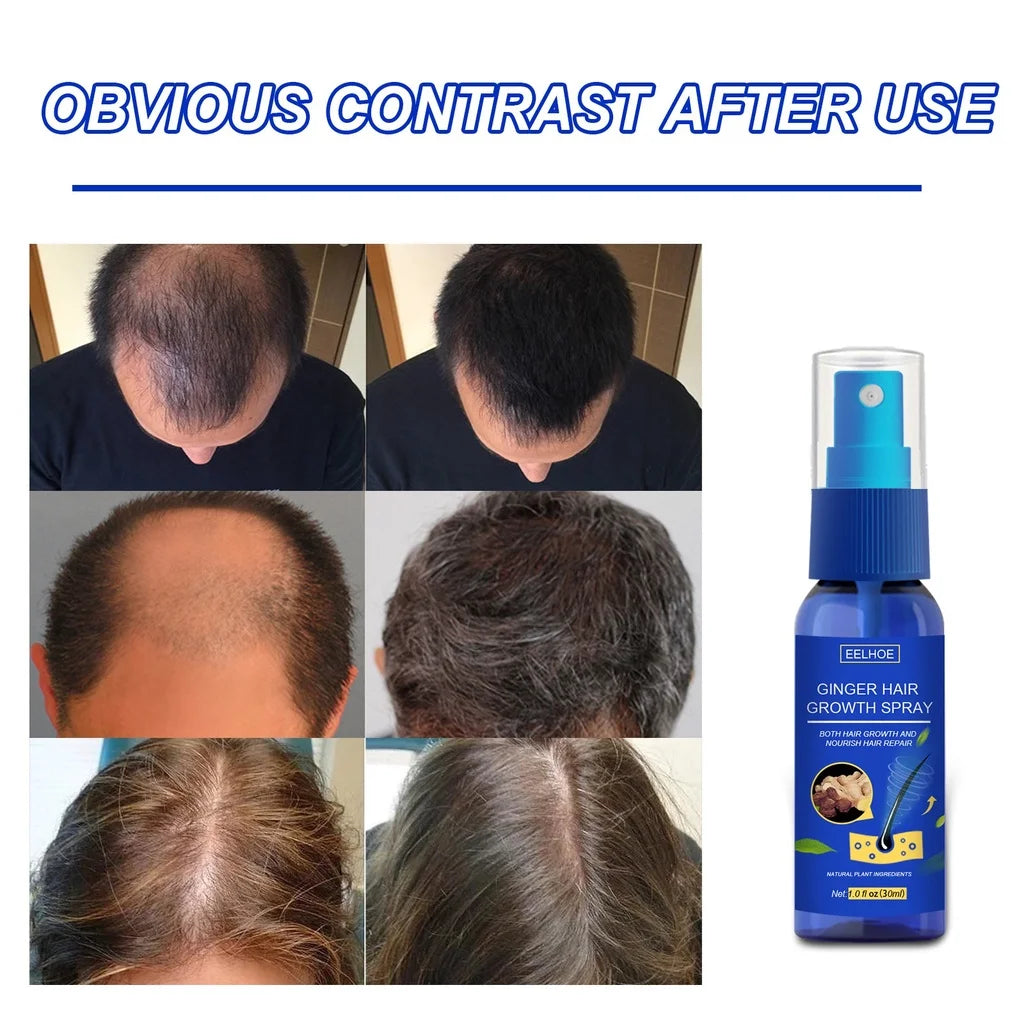 Ginger Hair Growth spray Anti Hair Fall Hair Loss Treatment